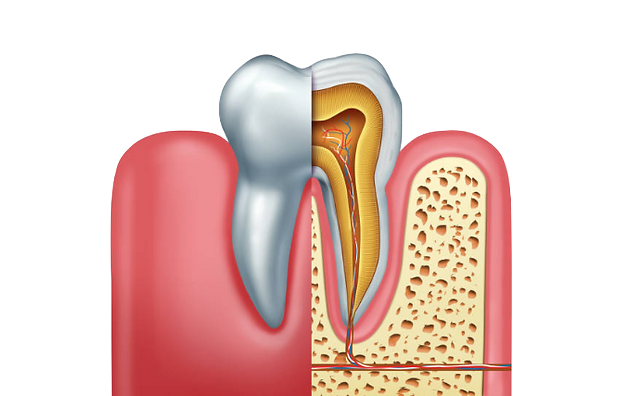 Root canal tretment | RCT